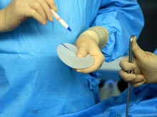 Грудные имплантаты PIP вызывают осложнения даже после удаления