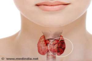 По исследованиям, среди молодых больных раком щитовидной железы отмечена высокая выживаемость