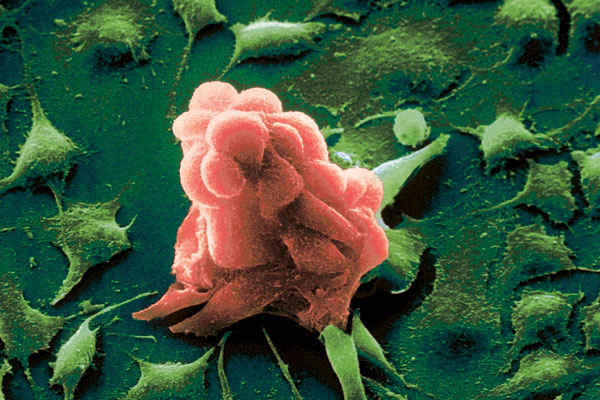 Ученые расшифровали клеточный путеводитель белков, связанных с раком и другими болезнями