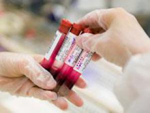Элементарный анализ крови расскажет, насколько эффективно лечение рака