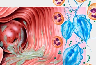 Диагностика и лечение вульвита Диагностика и лечение вульвита