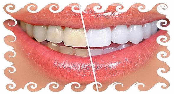 Как отбелить зубы народными средствами