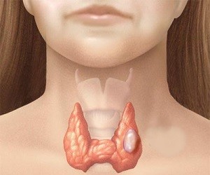 От чего стоит отказаться ради здоровой щитовидной железы